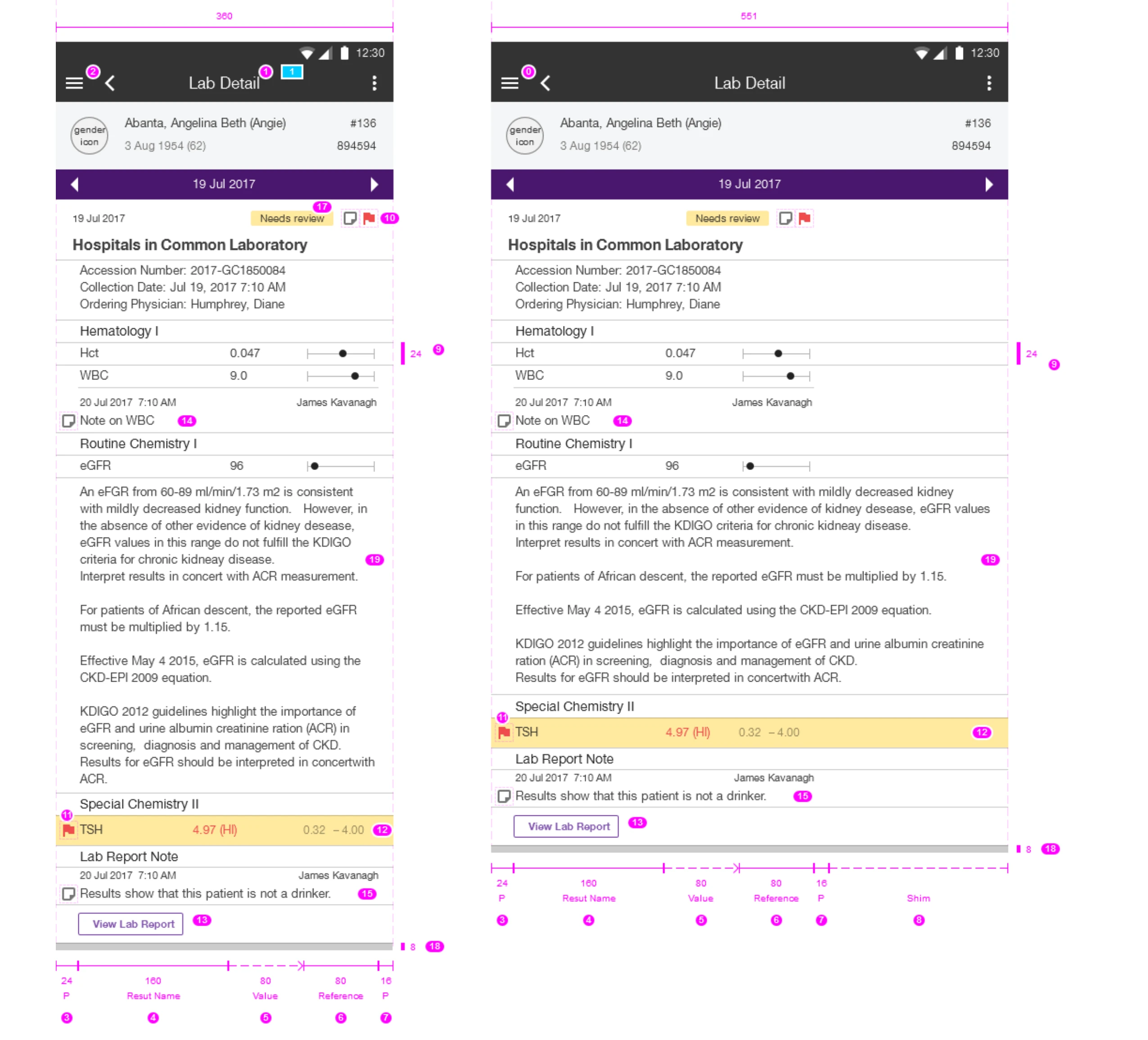 The lab-report detail laid out at two phone widths, 360dp and 551dp.